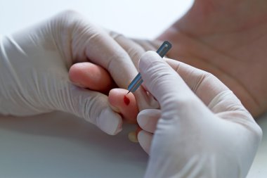 Doktor ve beyaz eldiven el göstermek kan testi kan lancet tarafından