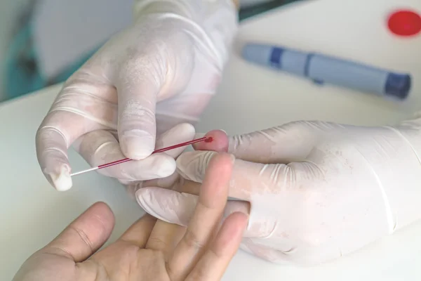 Glucómetro de sangre, el valor de azúcar en sangre se mide en un dedo — Foto de Stock