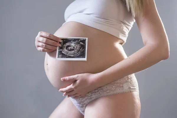 Mujer embarazada sosteniendo una radiografía — Foto de Stock