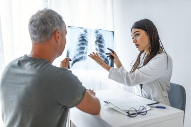 Genç doktor kamarasında bir hastayla konuşuyor. Doktor hastaya röntgen gösteriyor. Doktor ve hasta muayene odasında Xray 'e bakıyor. Doktor hastanın göğüs röntgenini gösteriyor.