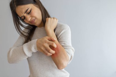 Sağlık sorunları, deri hastalıkları. Kaşındıran kolunu alerji isiliği ile kaşıyan genç bir kadın. Kolunu kaşıyan bir kadın. Kadın içeride kolunu kaşıyor, mesaj için yer var. Alerji belirtileri.