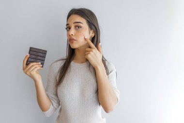 Cildinde sorun olan genç bir kadın çikolatayı tutuyor ve gri renkli kameraya bakıyor. Genç Kadın Sivilceli Sorunlu Surat Çikolatalı Mutsuz Yemek, Stresli Yüzü.