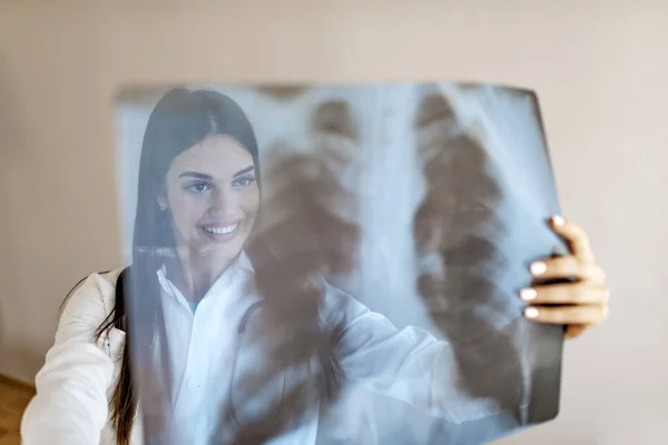 Orvos Vizsgálja Tüdő Radiográfiát Orvos Ellenőrzi Mellkasröntgent Kórházban Fiatal Doktornő — Stock Fotó