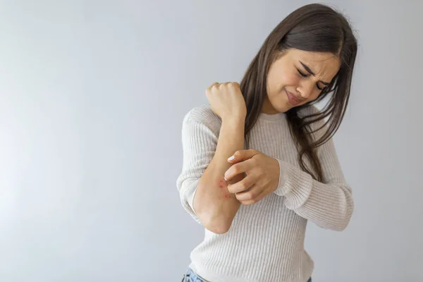 女人用手抓痒 用保健和药物概念 女人在灰色背景上挠着胳膊 过敏症状 女人抓着她的胳膊 — 图库照片