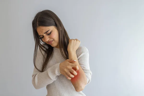 Mujer Arañando Una Comezón Sobre Fondo Blanco Piel Sensible Síntomas — Foto de Stock