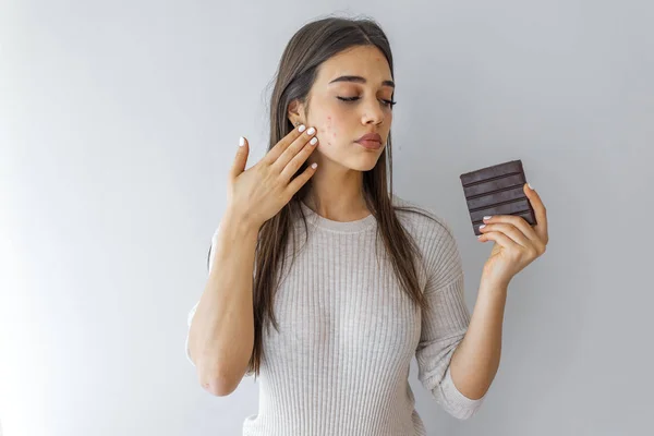 Young Woman Acne Problem Holding Chocolate Bar Grey Background Skin — Stock Photo, Image