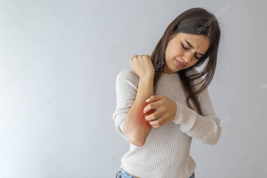 Health problem, skin diseases. Young woman scratching her itchy arm with allergy rash. Woman scratching her arm. Woman scratching arm indoors, space for text. Allergy symptoms