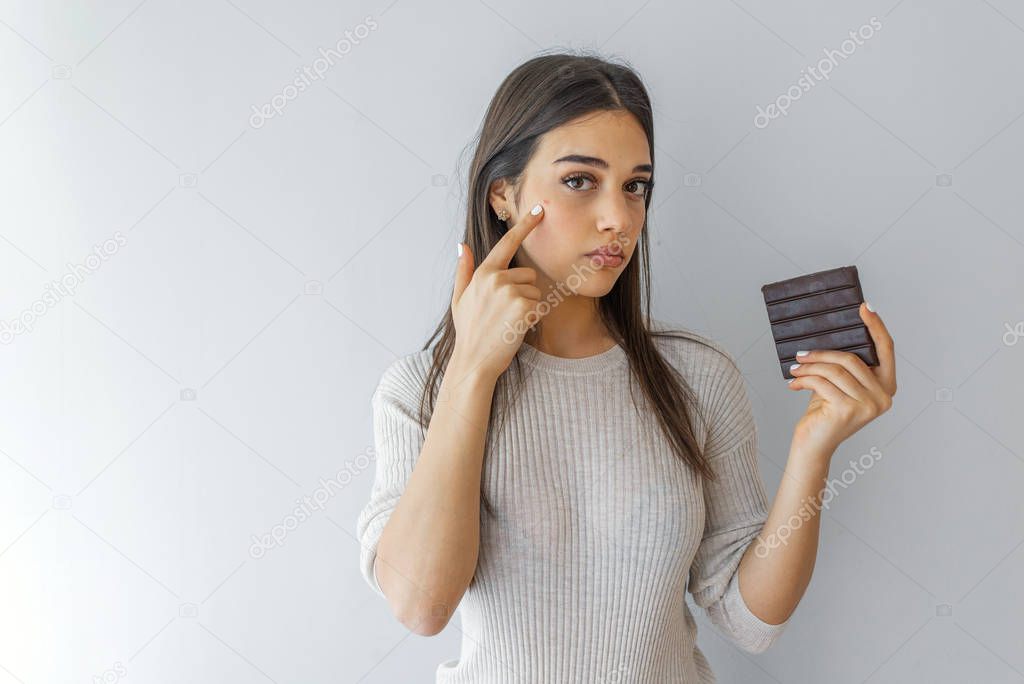 Closeup Acne Problem Face Woman Eating Chocolate bar. Young woman with acne problem eating chocolate bar and sweets . Skin allergy. Concept of skin problems. 