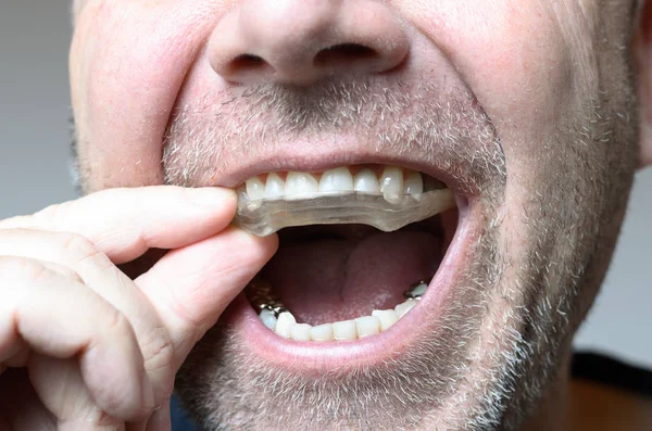 Τοποθέτηση ενός πιάτου μπουκιά στο στόμα του ανθρώπου — Φωτογραφία Αρχείου