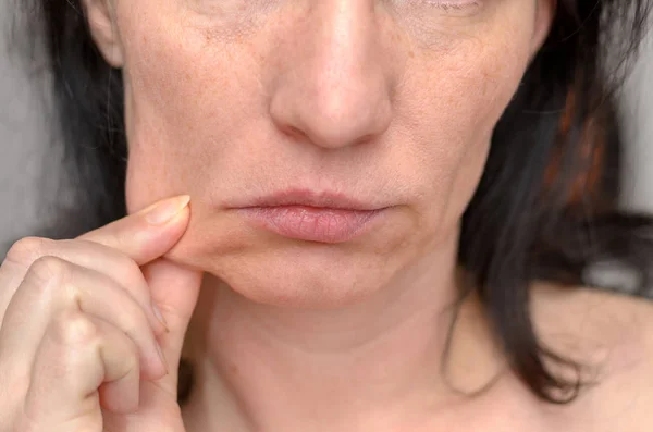 Woman pinching the skin of her cheek