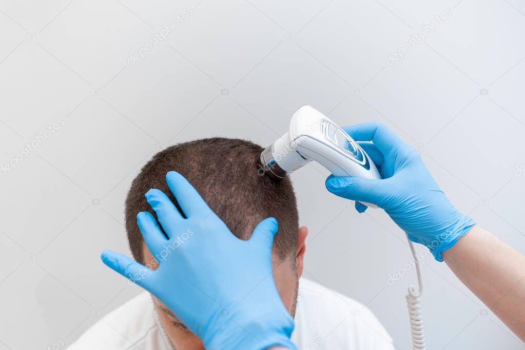 Trichoscopy of hair and scalp closeup. Trichoscope in the hands of a doctor