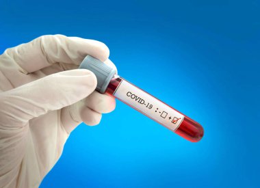 Koronavirüs için kan testi pozitif çıktı. Tıbbi müdahale, üzerinde kan olan test tüpü, lateks tıbbi eldiven. Coronavirüs salgını ve grip. 2019-ncov, covid-19, sarar.