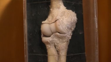 Clodeup anatomi Müzesi'nde insan organ