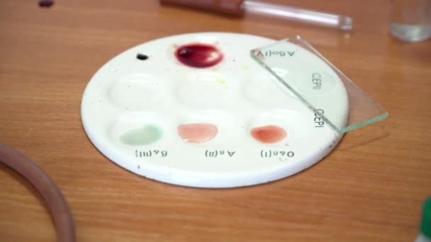 Närbild av blodprov på bordet i labbet — Stockvideo