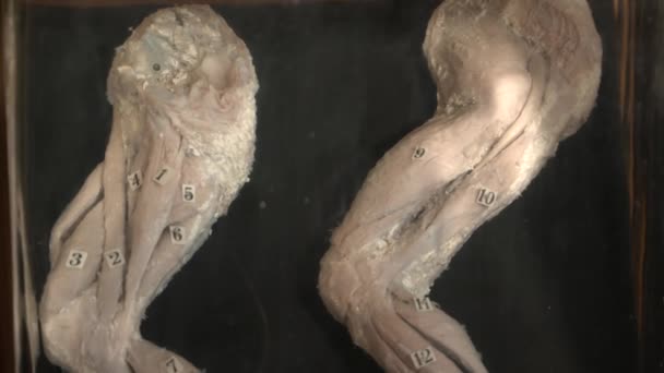 Acercamiento del órgano humano en el museo de anatomía — Vídeo de stock