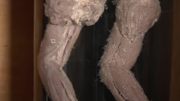 Clodeup lidského orgánu v anatomické muzeum