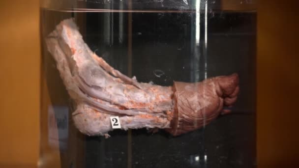 Clodeup van menselijke orgaan in het museum van de anatomie — Stockvideo