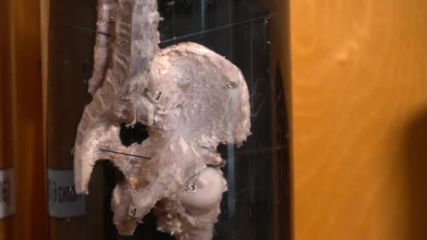 Clodeup van menselijke orgaan in het museum van de anatomie — Stockvideo