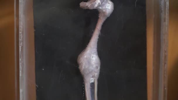 Clodeup 的人体器官解剖博物馆 — 图库视频影像