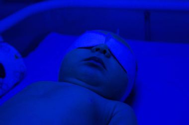  Yeni doğmuş fototerapi lamba