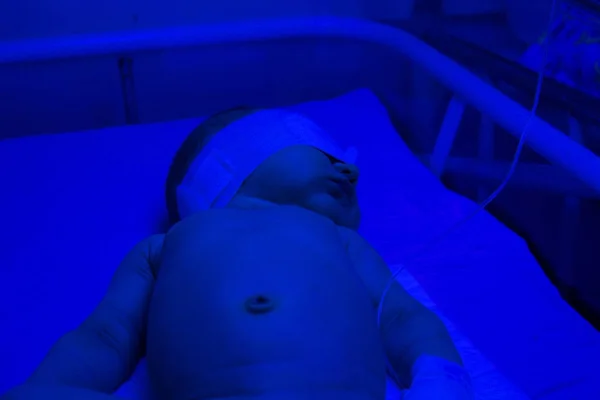 Лечение желтухи новорожденным в больнице — стоковое фото