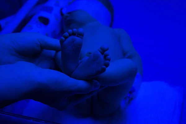 Новонароджена дитина має лікування жовтяниці під ультрафіолетом — стокове фото