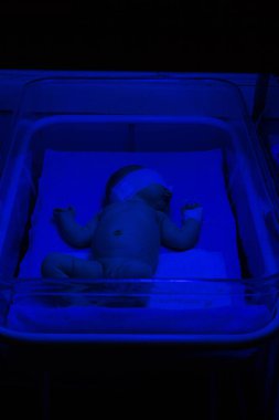 Yeni doğan bebek mavi Uv phototheraphy bebek savaş için ışığı altında