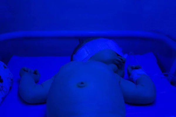 Νεογέννητο υπό την λάμπα υπεριώδους ακτινοβολίας. Μωρό παιδί έχοντας ένα παστώνοντας — Φωτογραφία Αρχείου