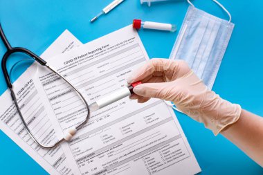 Doktorun elinde kovid 19 için kan testi yapılan bir tüp var. Laboratuvarda koronavirüs enfeksiyonu testi yapın. Yeni konsept 2019-nCov virüsü Wuhan, Çin 'den geliyor.