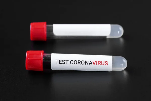 Bir Vakum Tüpünde Coronavirus Test Metni Üzerinde Kan Testi Siyah — Stok fotoğraf
