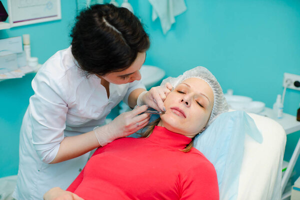 Contour plastic lip and nasolabial folds with a hyaluronic acid based filler