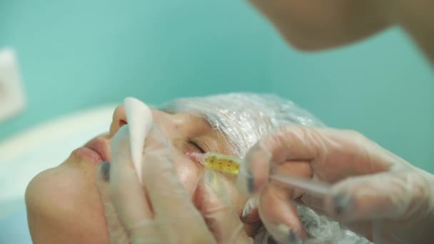 Cosmetología médica de la inyección de plasma — Vídeos de Stock