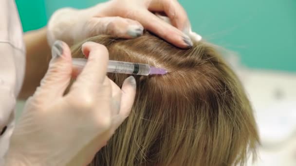 Mezoterapie vlasové pokožky — Stock video