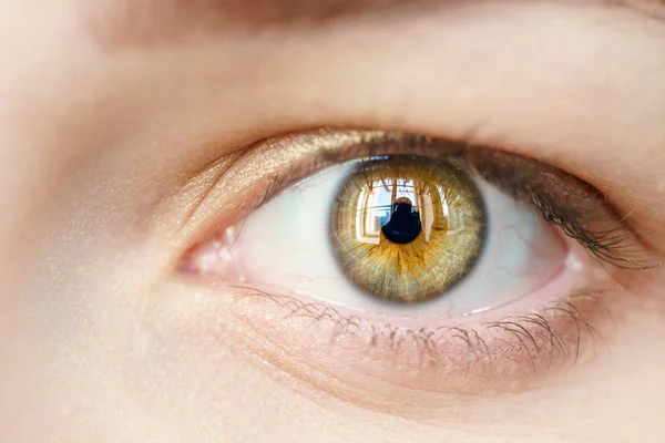 Tek gözü yeşil kız makro