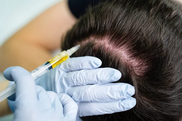 Inyección de plasma en la cabeza hombre cabello médico cosmetólogo — Foto de Stock