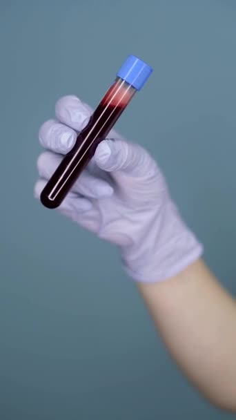 Δοκιμαστικό σωλήνα με αίμα στο γάντι λατέξ χέρι σε ένα ομοιόμορφο φόντο ρωγμή κάθετη βίντεο — Αρχείο Βίντεο