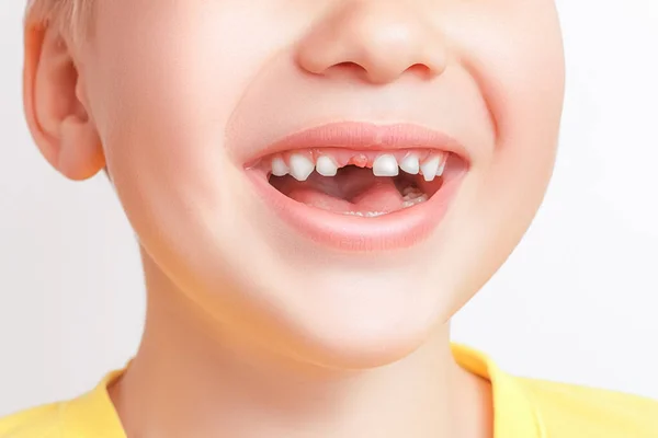 Χαρούμενο Χαμογελαστό Καυκάσιο Αγόρι Που Δείχνει Πρώτο Δόντι Γάλακτος Που Εικόνα Αρχείου