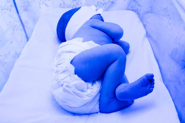 Jaundice of newborns. A child under a photo — Stock Photo, Image