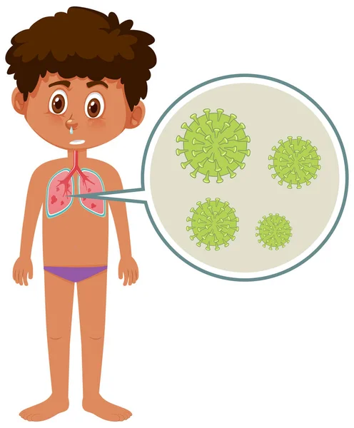 Beteg fiú koronavírus fehér alapon — Stock Vector