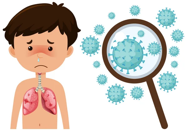 Sick boy from coronavirus with zoom up cells — ストックベクタ