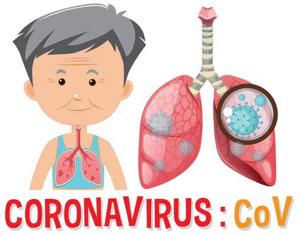 Desenho Cartaz Coronavírus Com Homem Velho Ilustração Pulmões —  Vetores de Stock