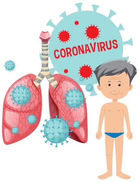 Projekt Plakatu Koronawirusa Chorym Człowiekiem Komórkami Płucach Ilustracja — Wektor stockowy