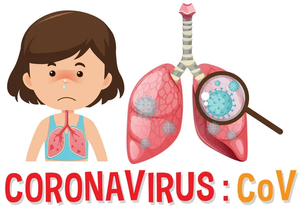 Projekt Plakatu Koronawirusa Dziewczyną Ciężkimi Płucami Ilustracja — Wektor stockowy