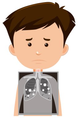 Akciğer röntgeni olan çocuk.