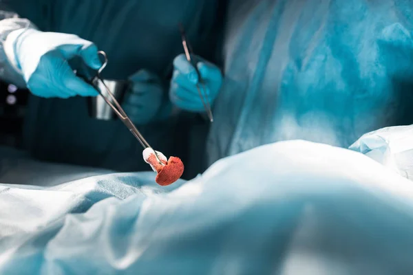 Обрезанное Изображение Хирургов Хирургическим Пинцетом — стоковое фото