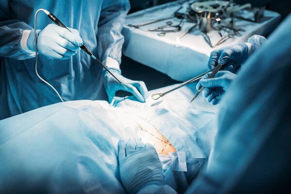 обрезанное изображение хирургов, оперирующих пациента в операционной
