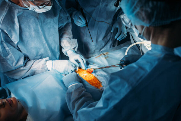обрезанное изображение хирургов, оперирующих пациента в операционной
