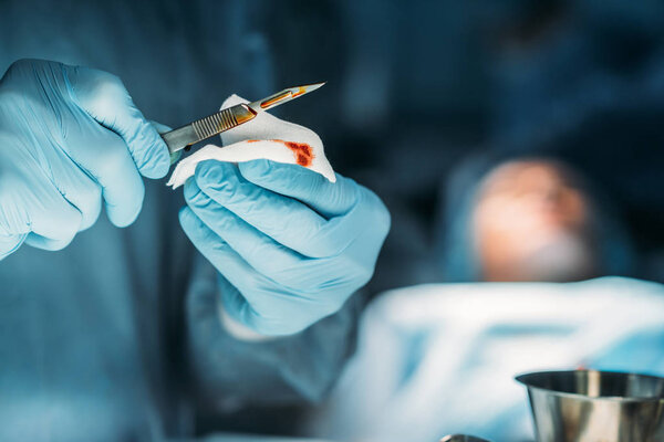 cropped image of surgeon cleaning scalpel from blood