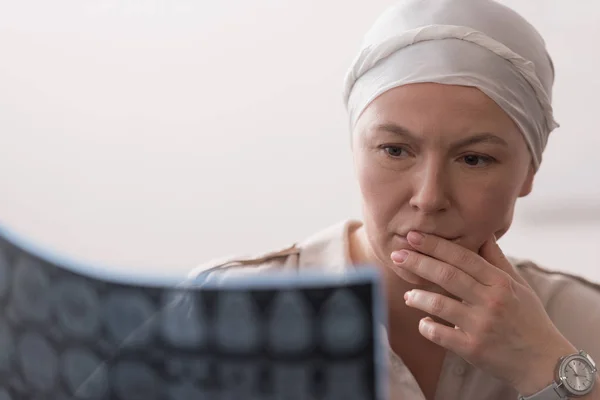 重度病态成熟妇女在头巾 Mri 扫描中的特写查看 — 图库照片