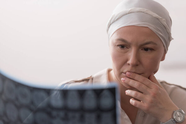 close-up view of serious sick mature woman in kerchief holding mri scan 